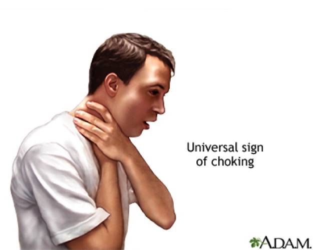 喉咙食物堵住了怎么办,食物卡住喉咙的急救方法