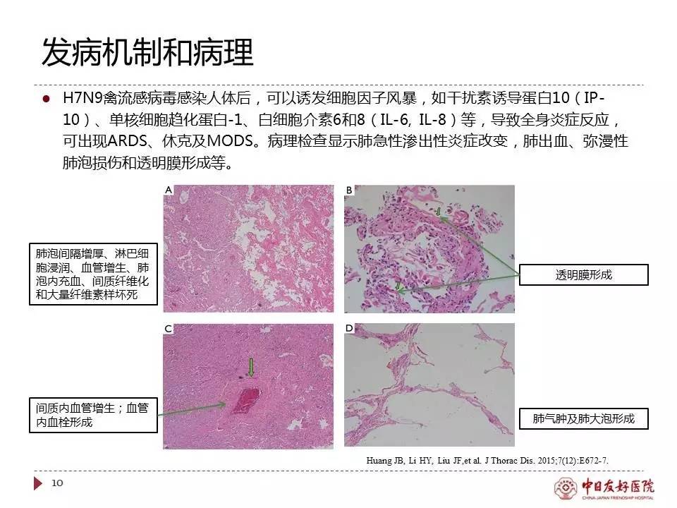 「规范与指南」人感染H7N9禽流感诊疗方案（2017年第一版）