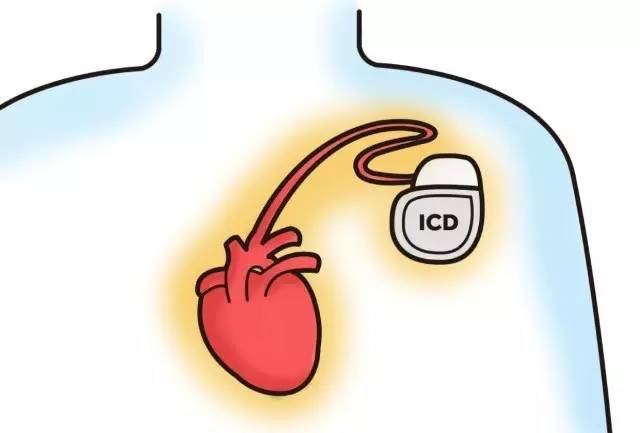 心脏泵力不够会导致血压低吗,心脏泵力不够的危害