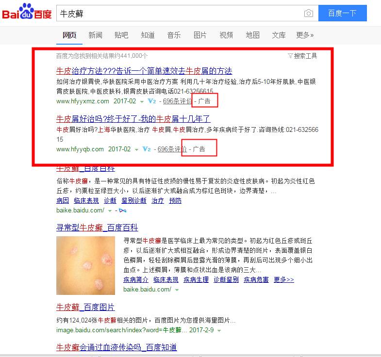 曾让你们咬牙切齿的百度医疗广告怎么样了？