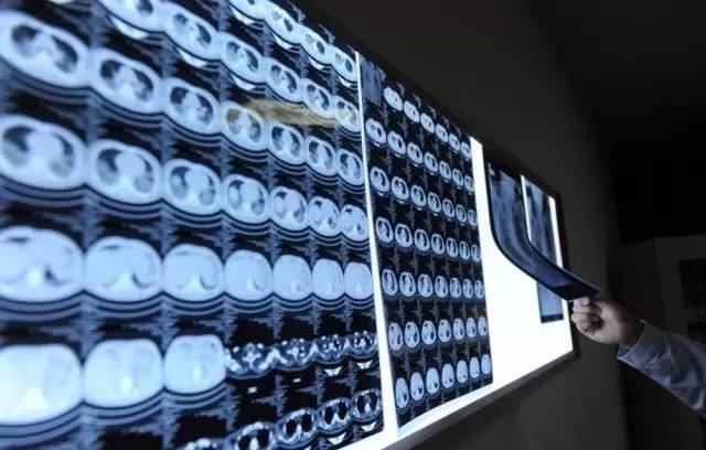 湖南h7n9禽流感病例,湖南治愈了多少例