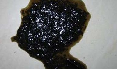 婴儿大便墨绿色是吓到了吗,为什么一个多月的宝宝大便有点黑