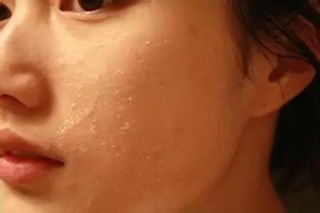 怎么做好脸部护理,肌肤补水护理方法