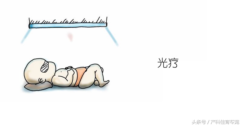 突然发现宝宝皮肤黄,宝宝皮肤黄原来是这些原因导致的