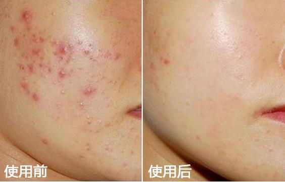 旅行必备单品大全,旅行必备单品美妆