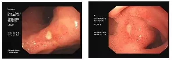 舌苔辨证图谱望舌识病,揭秘舌苔图谱轻松自诊