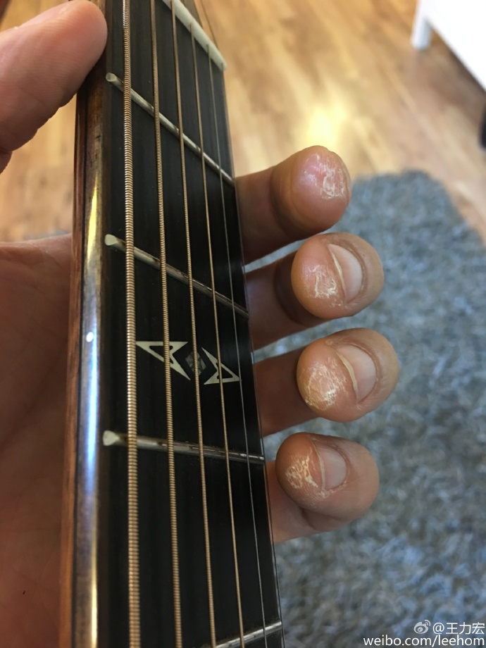 如何练吉他左手不会起茧,练吉他手指起茧会难看吗