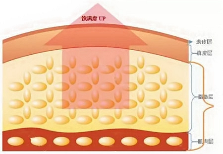自体脂肪丰额头的案例,自体脂肪丰额头效果如何