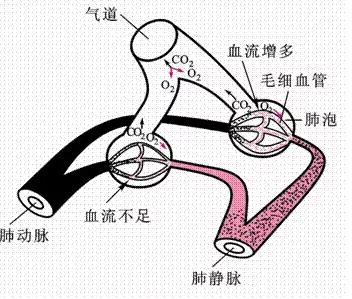 呼吸衰竭护理,呼吸衰竭动画