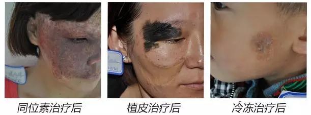 网友吐槽：三生三世十里的桃花，这一世该许给谁？