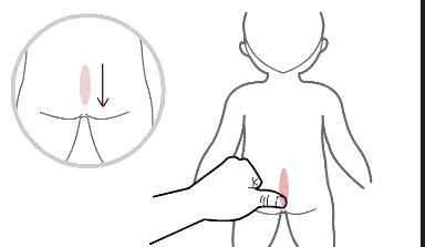 宝宝积食有效解决方法,宝宝积食要怎么办才能最快最有效
