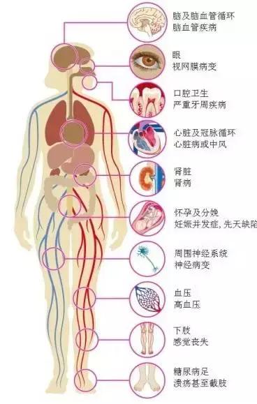 谈一谈糖尿病的话题,王意忠干细胞治疗糖尿病