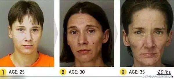 如何从牙齿上判断小孩是否铅中毒,大人口腔细菌对宝宝危害真实案例