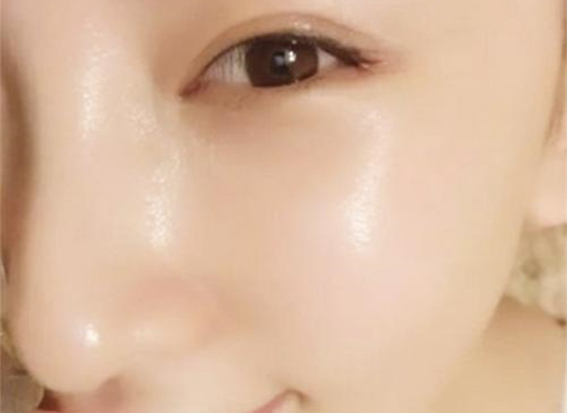 黑眼圈看起来没精神怎么办,黑眼圈太严重了眼睛没精神怎么办