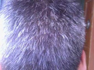 少白头怎么解释,少白头怎么说