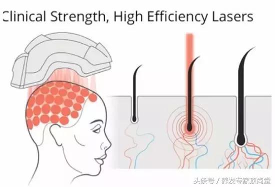 从头发看出体质,从头发就能看出身体疾病