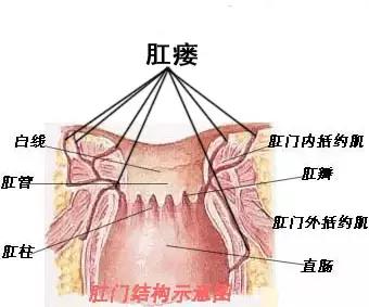 肛周长了个小包是怎么回事,肛周和肛瘘发病原因