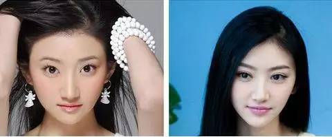 双眼皮怎么割没肉条感,双眼皮怎么显得更宽