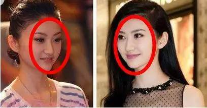 双眼皮怎么割没肉条感,双眼皮怎么显得更宽