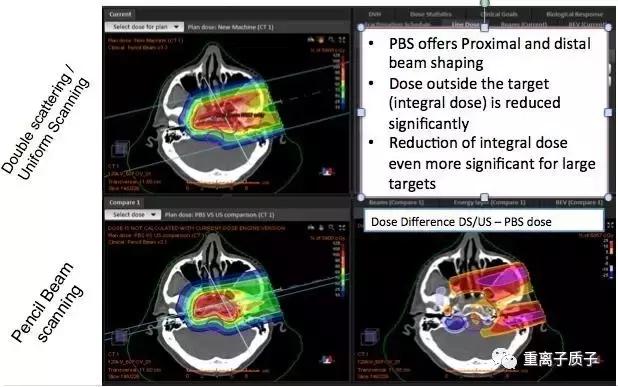 放射治疗技术参考文献,质子放疗新技术的进展