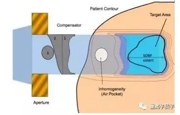 放射治疗技术参考文献,质子放疗新技术的进展
