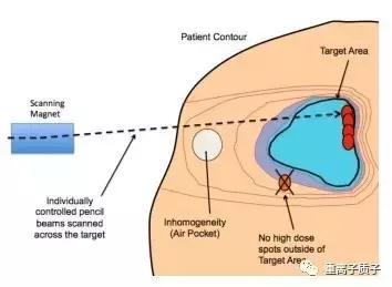 放射治疗技术参考文献,质子放疗新技术的进展