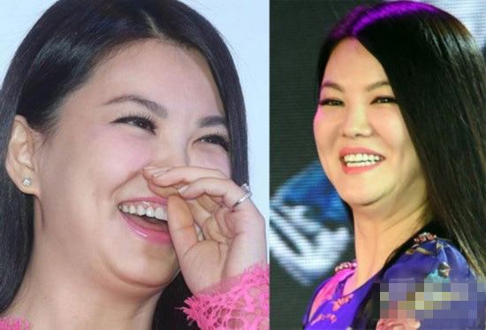 黄金微针祛除颈纹,去除颈纹的微针视频