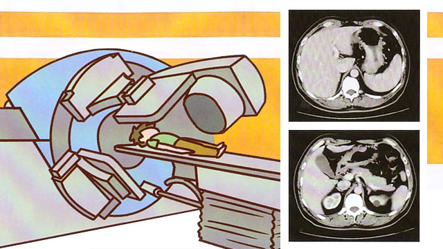 磁控胶囊胃镜和插管胃镜哪个准确,无痛胃镜和插管胃镜的区别