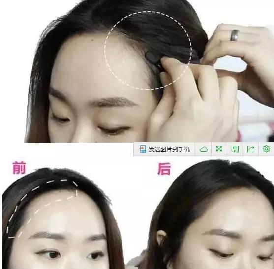 大幂幂凸显发际线,大幂幂发际线高