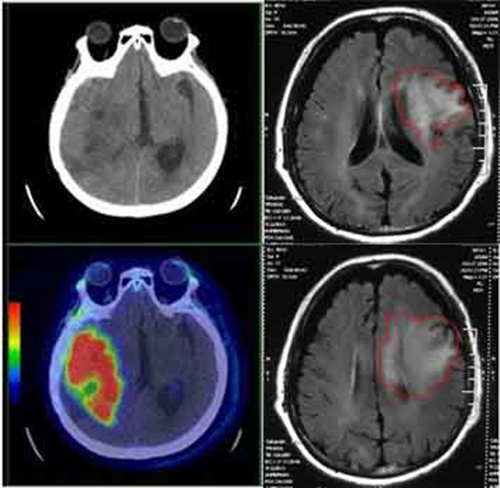 老年人头痛想吐什么原因,中老年人头晕想呕吐什么原因
