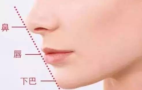 玻尿酸填充下巴一针还是两针好,玻尿酸丰下巴后要关注哪些问题