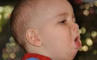 小孩咳嗽偏方立刻止咳,小孩咳嗽10大偏方