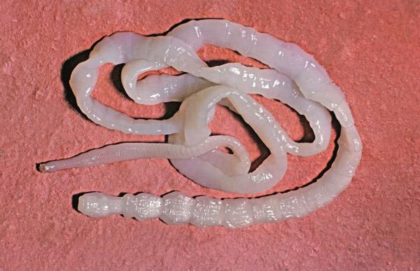 生肉去除寄生虫最好的办法,长期吃生肉18条寄生虫