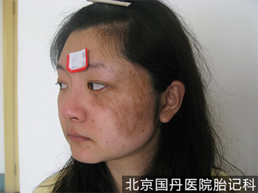 喝咖啡会长,喝咖啡真的会长斑吗