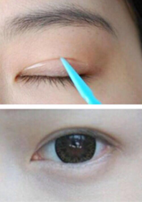 目前主流的双眼皮做法,现在流行的双眼皮简单大方超好看