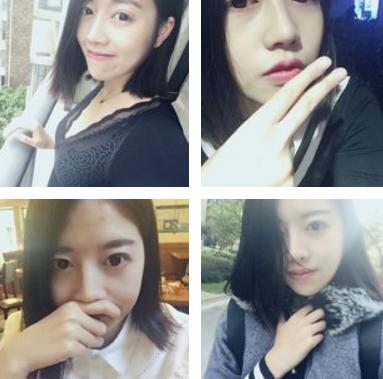 隆鼻后鼻子歪了如何手法矫正,硅胶隆鼻有点歪修复需要再付费吗