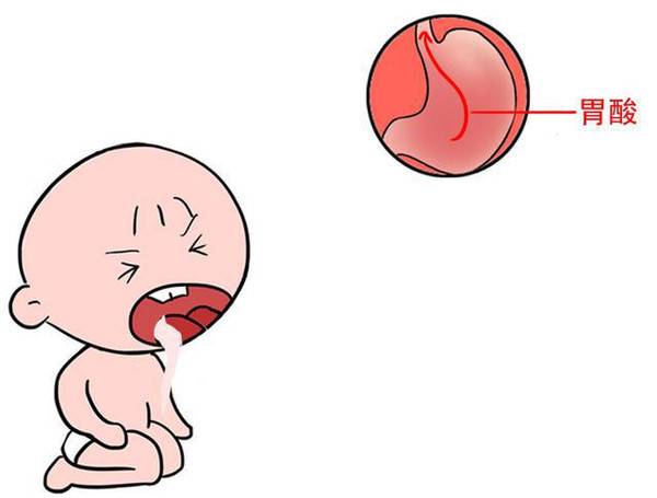 恶心呕吐患者的饮食指导,单纯的呕吐吃什么食物