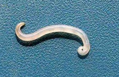 宝宝肚子有蛔虫会屁股痒吗,孩子肚子疼屁股痒是有虫吗