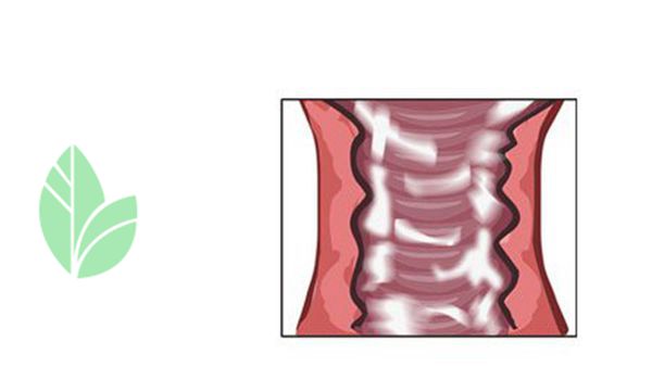 孕早期胎儿健康的症状,孕期阴道炎会影响胎儿有什么症状