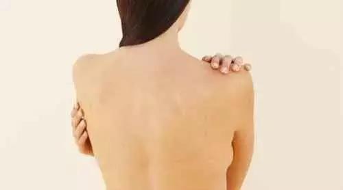 多关节挛缩治疗方法,手指关节挛缩的症状