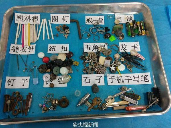 儿童误吞玩具在胃里,小孩误吞了玩具要怎么检查