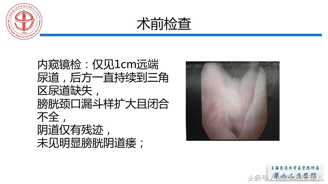 泌尿男科王忠教授,泌尿外科专家王忠教授