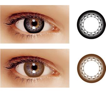 隐形眼镜藏在眼球半年,怎样检查隐形眼镜是否藏在眼球后