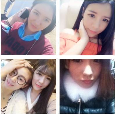 鼻子玻尿酸对比图,玻尿酸填充鼻子变宽后的图片