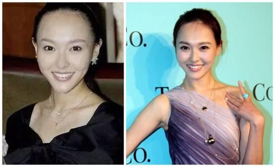 大幂幂凸显发际线,大幂幂发际线高