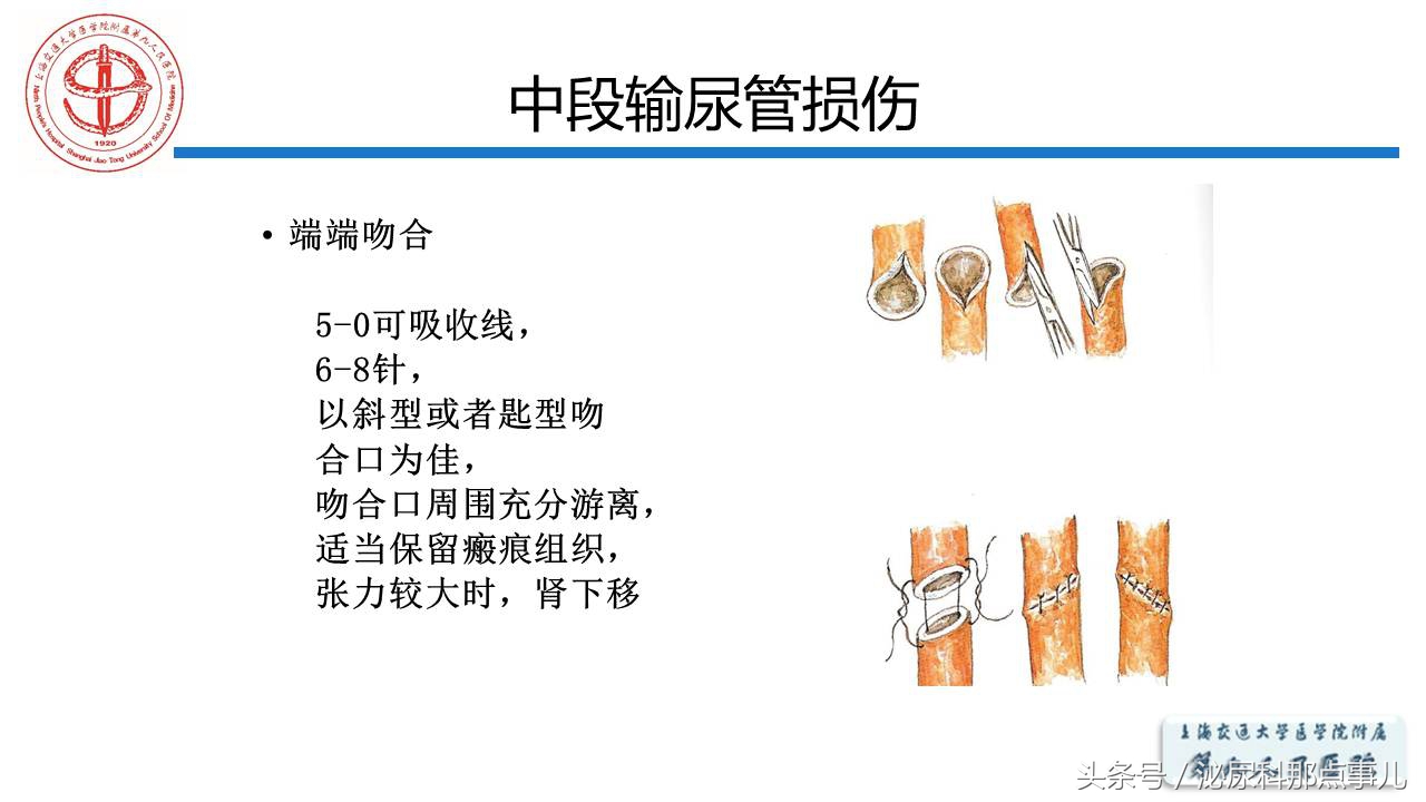泌尿男科王忠教授,泌尿外科专家王忠教授