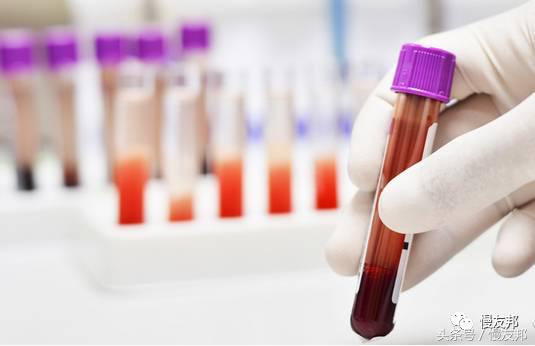 防治高血脂的九个误区,人们对高血脂的认知误区有哪些