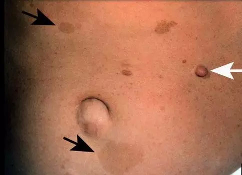 喝咖啡会长,喝咖啡真的会长斑吗