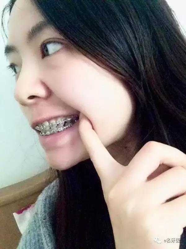 有牙洞并感觉到疼痛了,有牙洞很疼怎么办