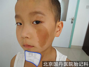 喝咖啡会长,喝咖啡真的会长斑吗